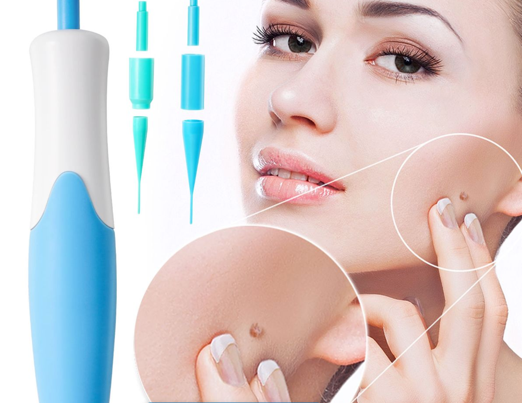 Skin Tag / Vratjie / Mole / Wart Removal Kit