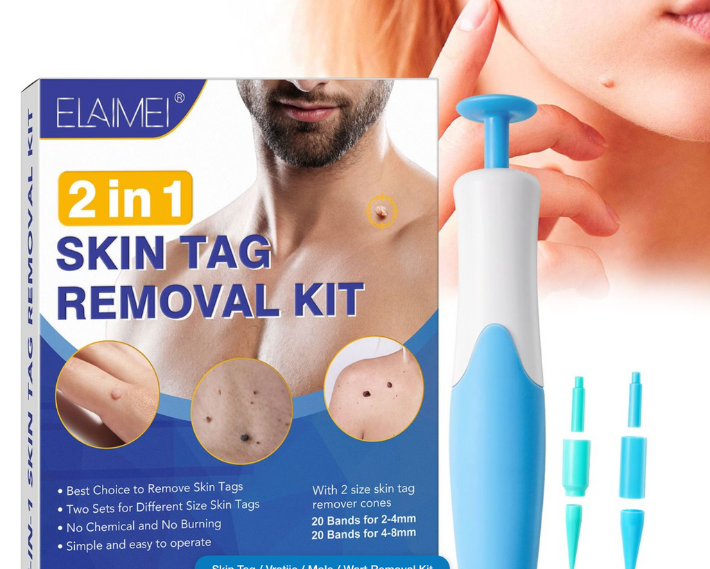 Skin Tag / Vratjie / Mole / Wart Removal Kit
