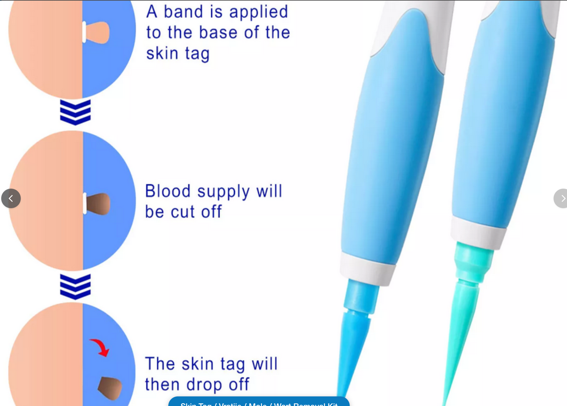 Skin Tag / Vratjie / Mole / Wart Removal Kit